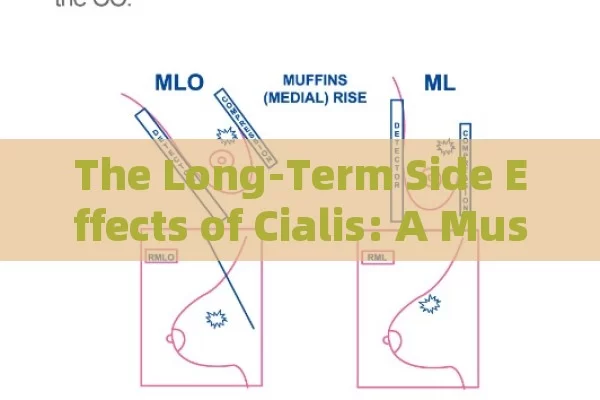 The Long-Term Side Effects of Cialis: A Must-Know